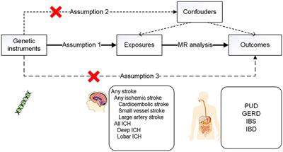 Stroke and the risk of gastrointestinal disorders: A Mendelian randomization study